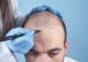 The benefits of liposuction and hair transplant hair transplant cost in Ludhiana