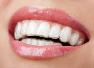 A Glimpse To Know The Solutions To Perfect Your Smile invisalign dentist berkshire