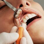 Why It’s Essential to Have an Annual Routine Teeth Cleaning