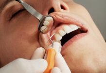 Why It’s Essential to Have an Annual Routine Teeth Cleaning